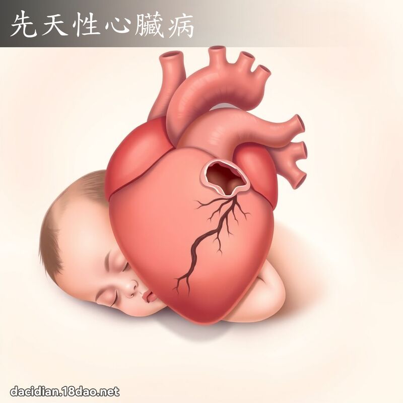 先天性心臟病 - 國語大辭典配圖