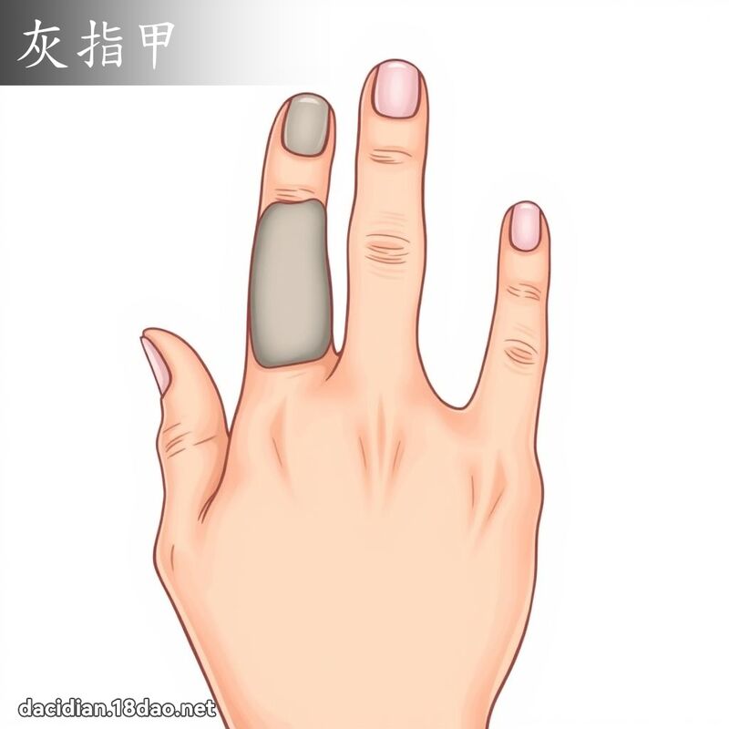 灰指甲 - 國語大辭典配圖