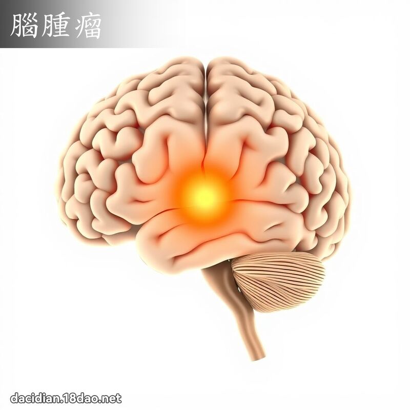 脑肿瘤 - 国语大辞典配图